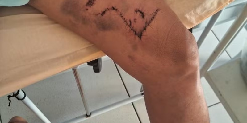 Leia mais sobre o artigo Mulher é atacada por onça-parda no Sertão de Pernambuco